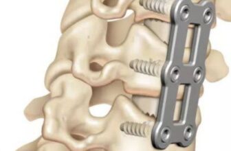 Contact Top Neuro Spine Surgeon in India: Meet the Best Cervical Spine Surgeon