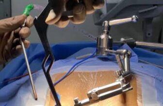 Meet a Top Spine Surgeon in Kolkata – Expert in Minimally Invasive Spine Surgery
