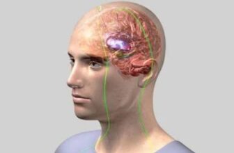 Brain Pacemaker for Parkinsons’: Contact the Top DBS Surgeon in Kolkata, India