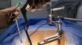 Meet a Top Spine Surgeon in Kolkata – Expert in Minimally Invasive Spine Surgery
